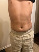 Anonymous review photo