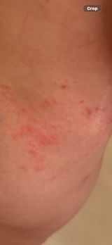 Anonymous review photo