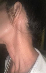 CT review photo