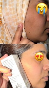 Anonymous review photo