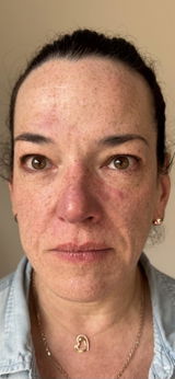 Rutina Completa con tu fórmula personalizada: contorno de ojos, serum, crema de día, crema de noche