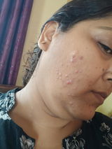 Shampa Basu review photo