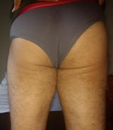 Anonymous review photo
