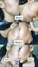Chloebkoetaan review photo