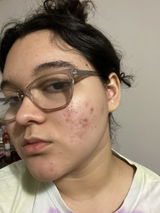 Suri V. review photo