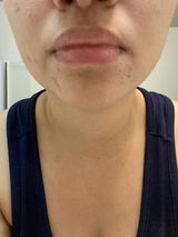Lore review photo