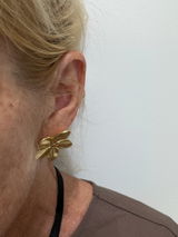 Anonym review photo