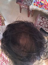 Anonymous review photo