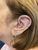Randi Berliner review photo