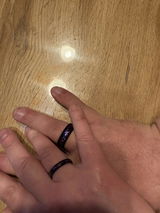 Anonym review photo
