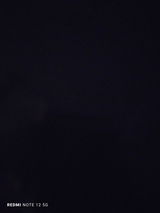 Anonyme review photo