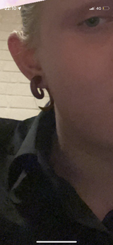 Anonymous review photo