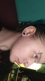 Anonymous review photo