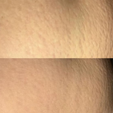 Akansha review photo