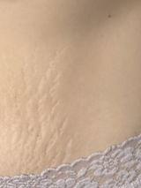 Tp review photo