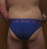 Anonymous review photo