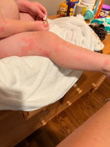 Anonymous review photo
