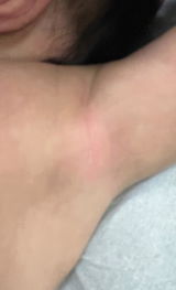 Anonymous review photo