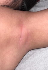 Anonymous review photo