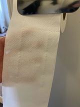 Anonym review photo
