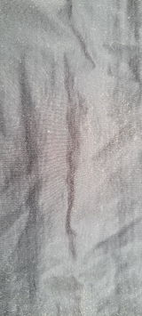 Anonym review photo