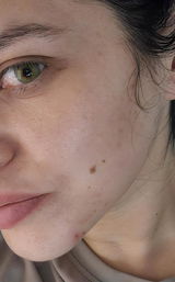 VANESSA review photo