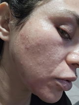 VANESSA review photo