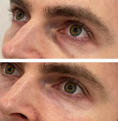 Prime Face System
