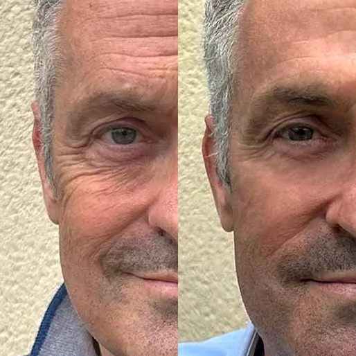 Prime Face System