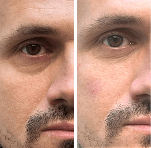 Prime Face System