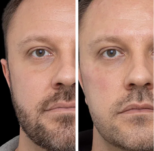 Prime Face System