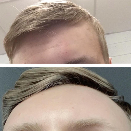 Prime Face System