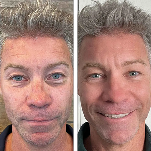 Prime Face System