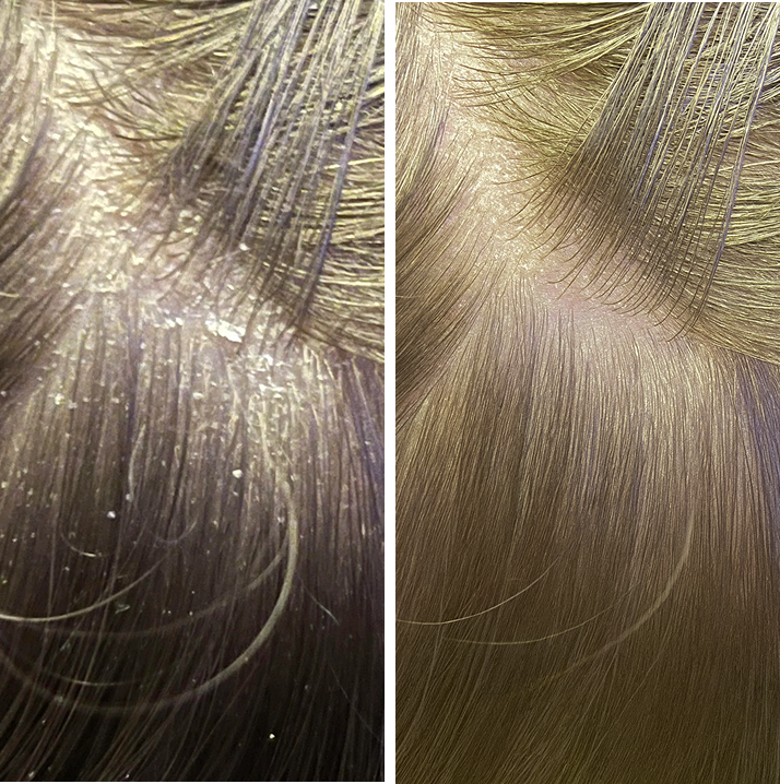 Root Resetter Scalp Scrub™