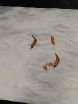 Anonymous review photo