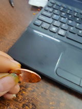 Dr. Ashish Gupta (Mumbai) review photo