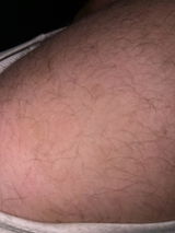 Anonymous review photo