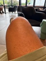 Anonymous review photo