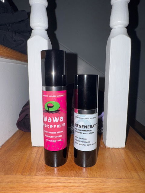 REGENERATOR CREAM - Anti-Inflammatory, Wound & Scar Healer, Eczema, Psoriasis, Under-Eye Fixer