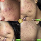 Preethi Iylig review photo