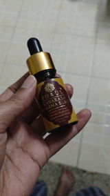 Anonymous review photo