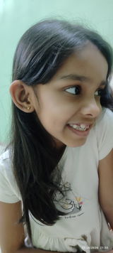 Prati review photo