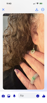 Anonymous review photo