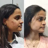Nimmi Jain review photo
