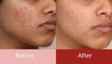 Archana review photo