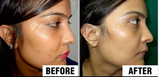 Pinky Thakur review photo