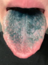 Mouthwash review photo
