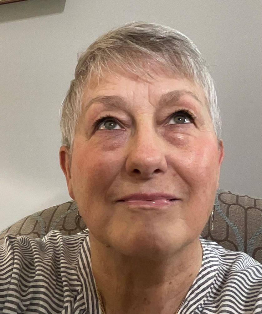 Before and After - Nancy Miller