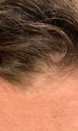 Better Scalp Sensitive Shampoo