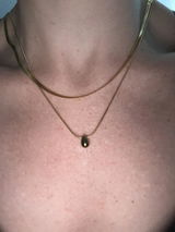 Anonymous review photo